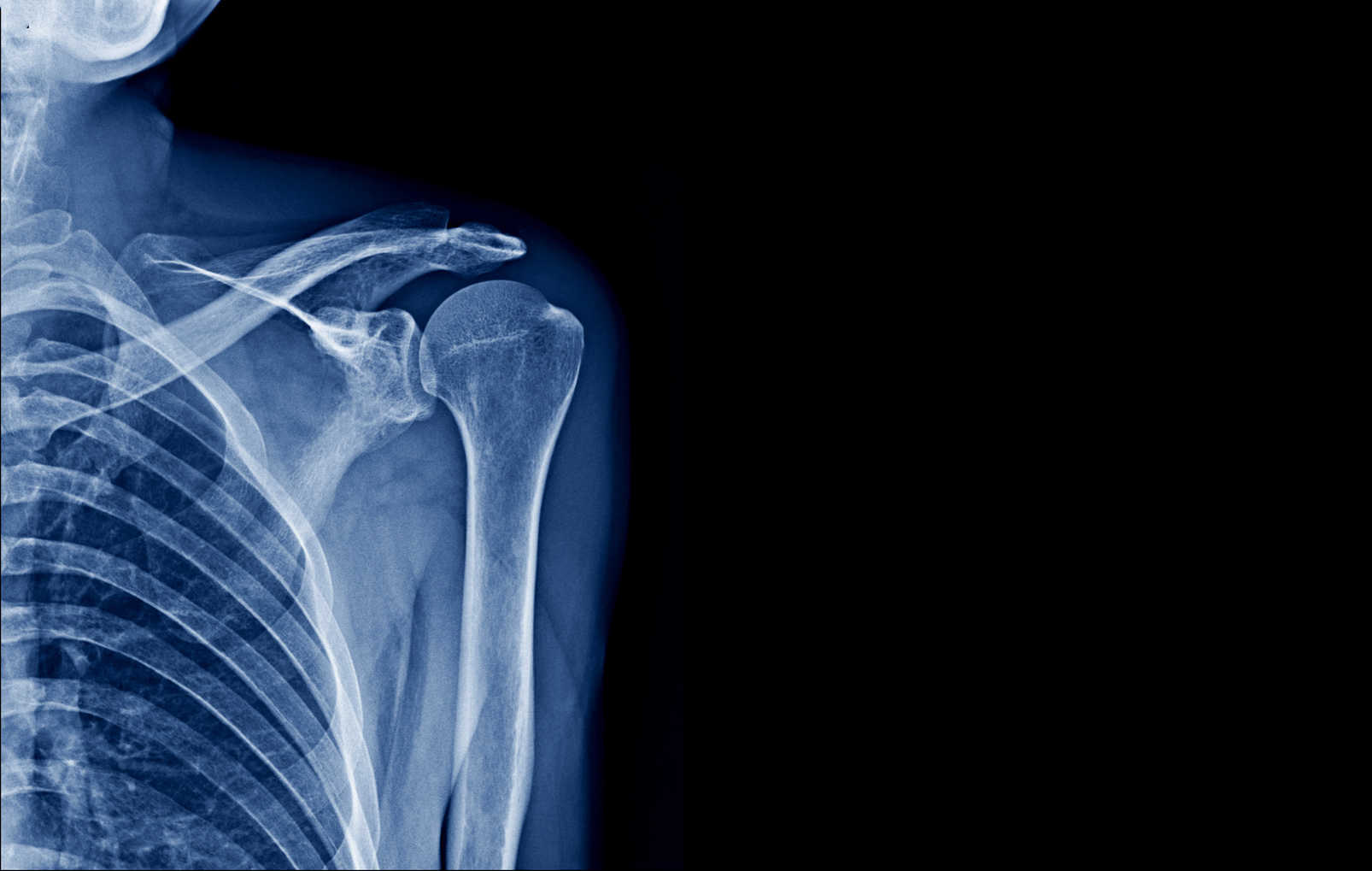 shoulder x-ray banner